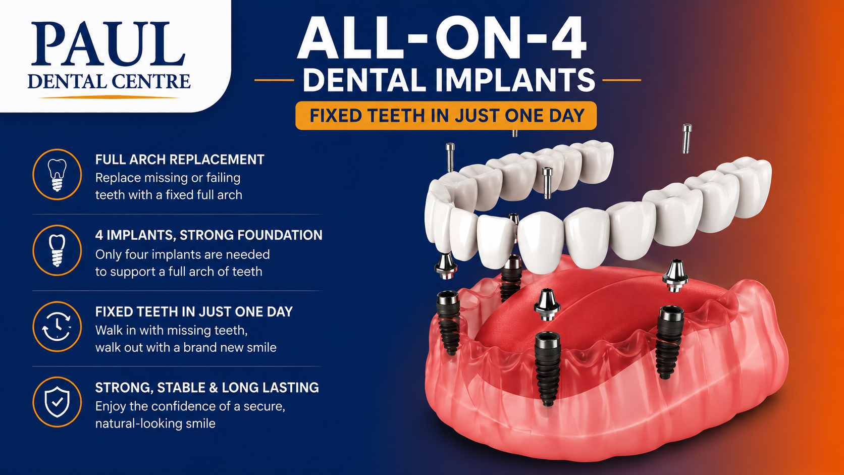 All-on-4 Full Mouth Restoration